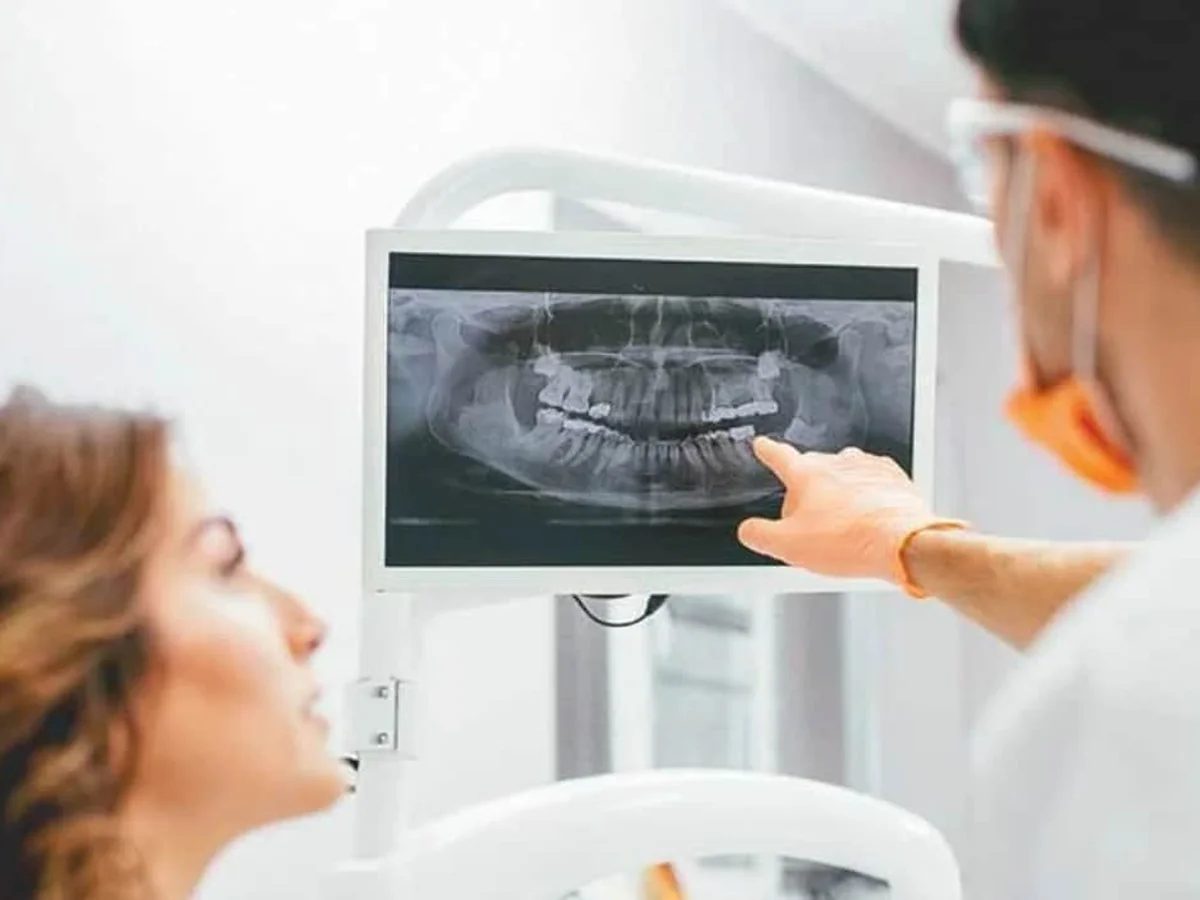 Digital dental X-ray on screen in the OC Plaza Dentistry office